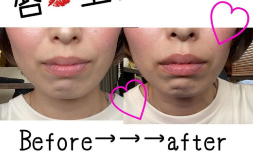 唇💋エステ🤩💕